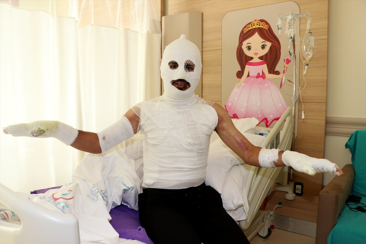 Erzurum’da sobayı tinerle yakmak istedi, vücudu yandı  #1