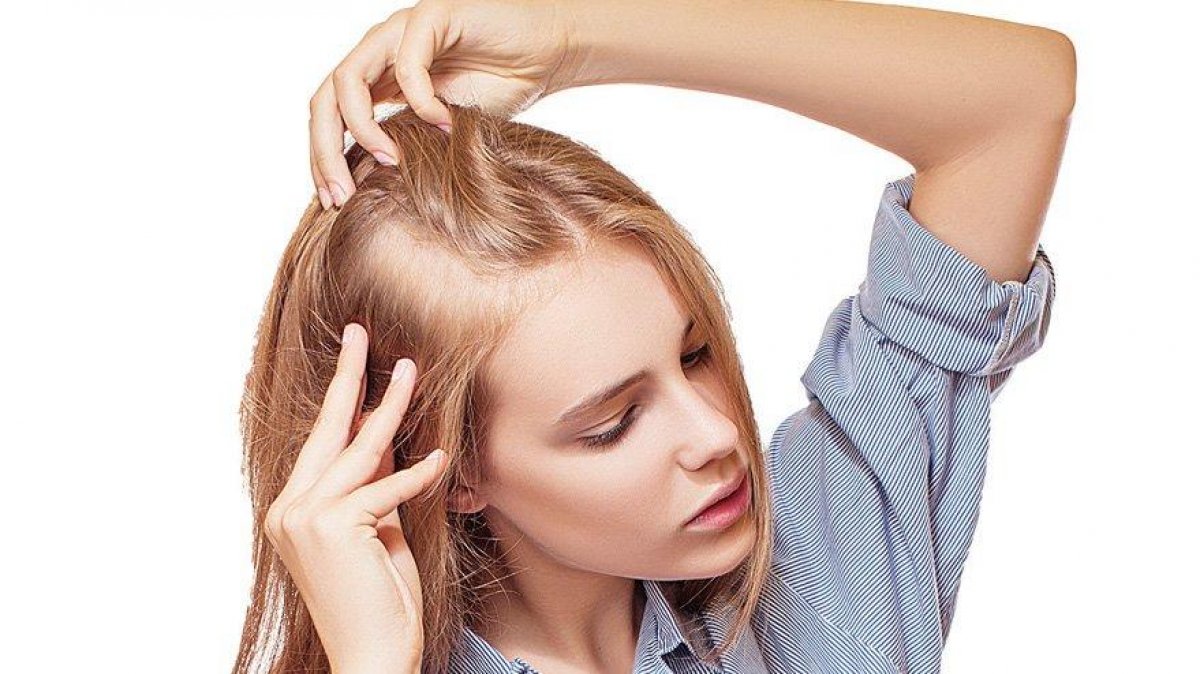 Duygusal travmalar, ani saç kaybına neden olabilir	 #1