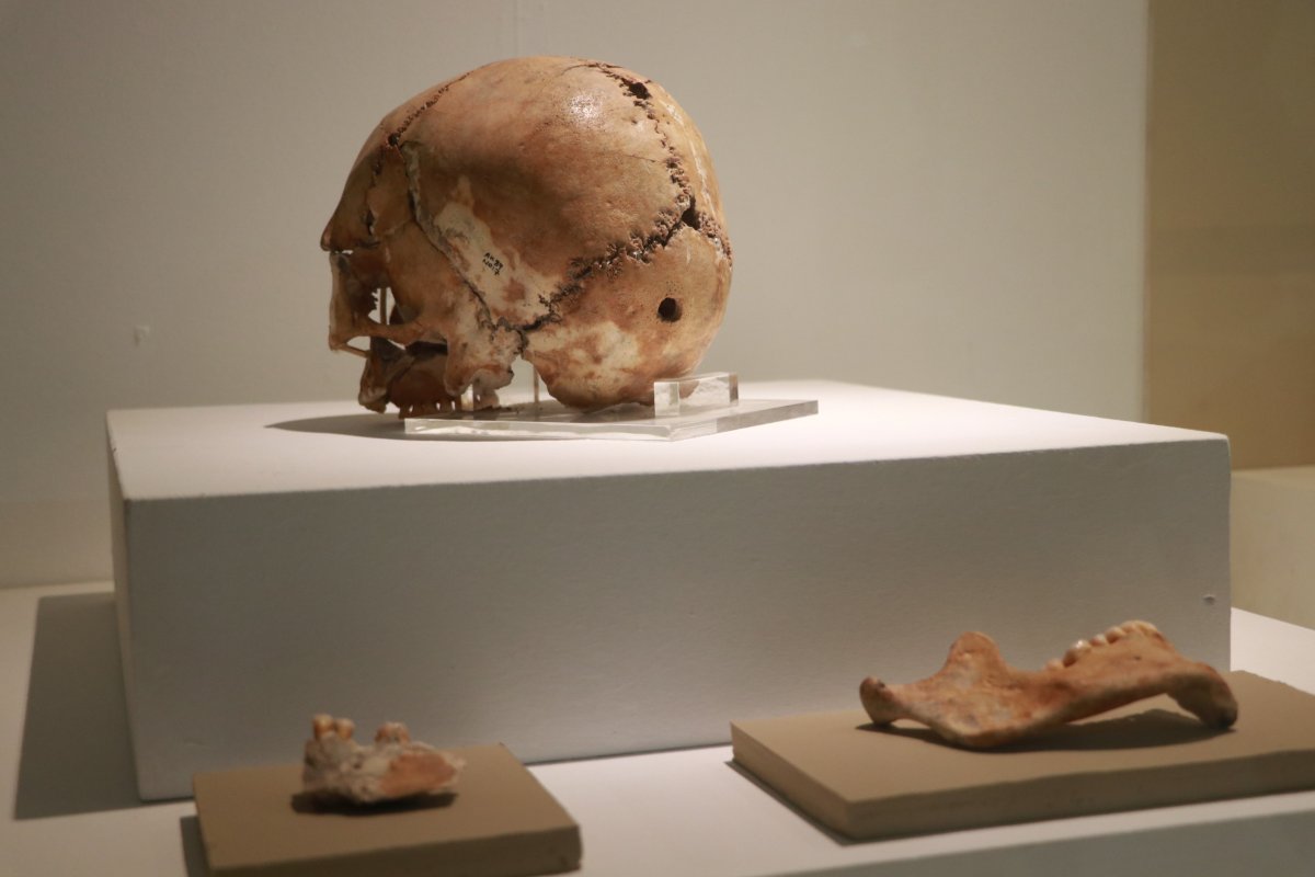 Dünyanın ilk beyin ameliyatı Aksaray da, 10 bin 500 yıl önce yapıldı #1