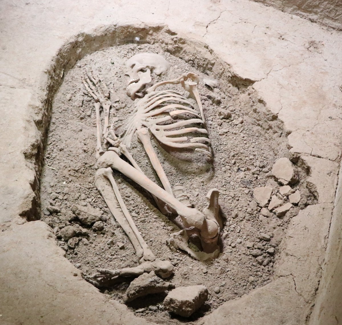Dünyanın ilk beyin ameliyatı Aksaray da, 10 bin 500 yıl önce yapıldı #5
