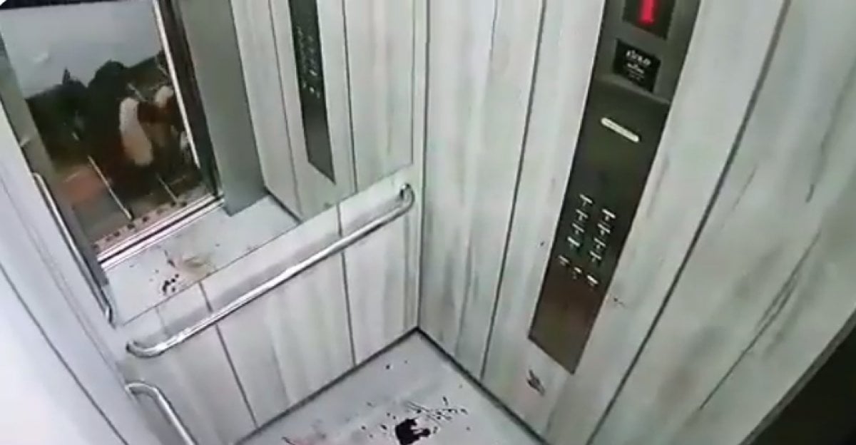 Kolombiya daki kadın, asansörde pitbull saldırısına uğradı #2