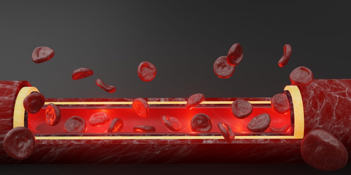 Aneminin en yaygın 6 belirtisi ve önlemenin doğal yolları #3