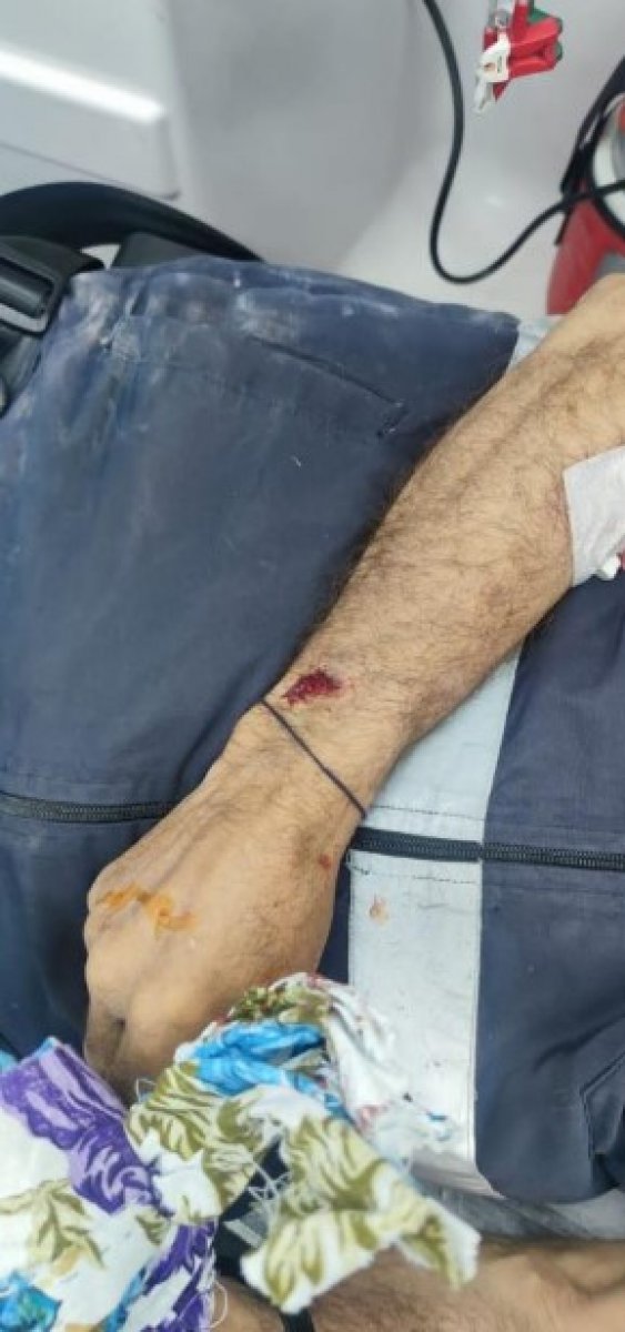 Diyarbakır da yaşlı adama köpekler saldırdı #2