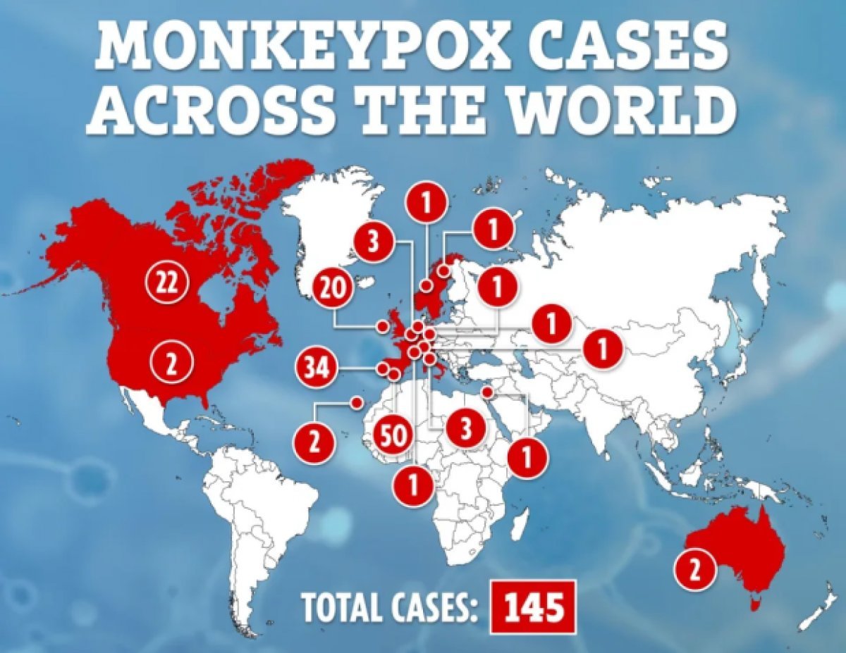Belgium declares quarantine against monkeypox #2