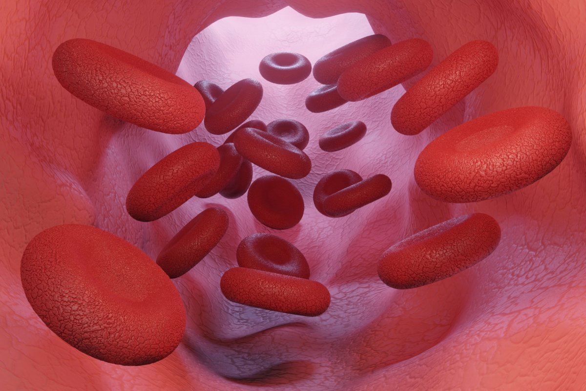 9 silent symptoms of anemia