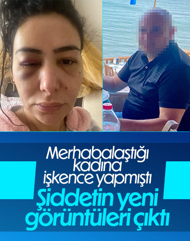 Adana'da 'merhabalaştığı' kadına işkence eden şahsın görüntüleri