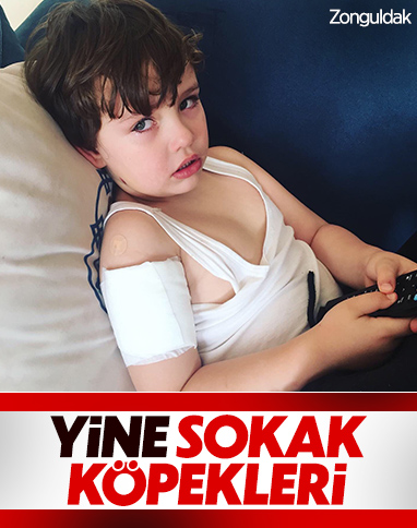 Zonguldak'ta 5 yaşındaki çocuğa köpek saldırısı