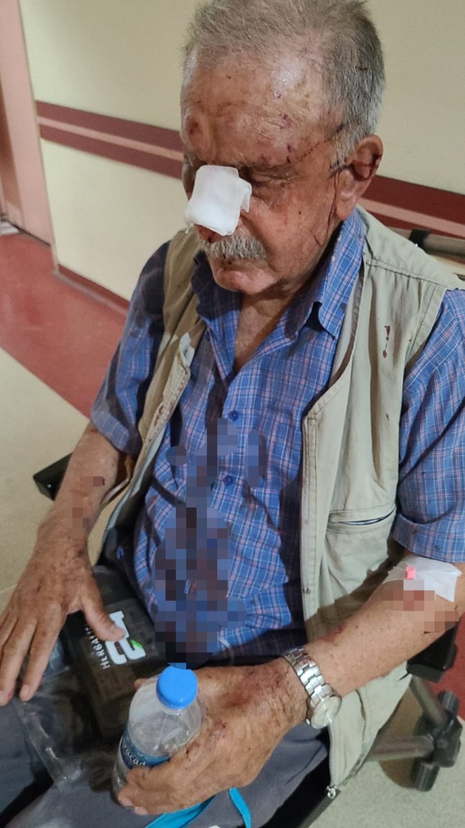Gaziantep te, yaşlı çift miras nedeniyle öldüresiye darbedildi #3