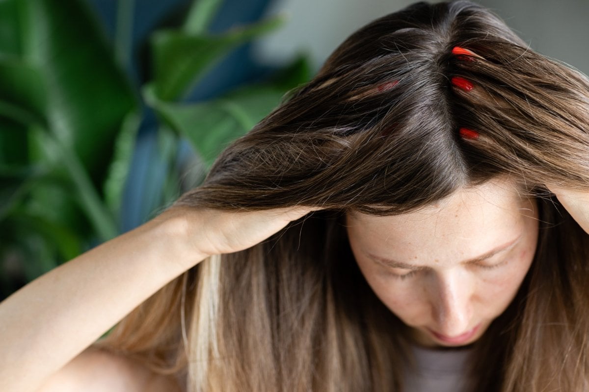 Saçlarda kepek oluşumunun en yaygın 5 nedeni #2