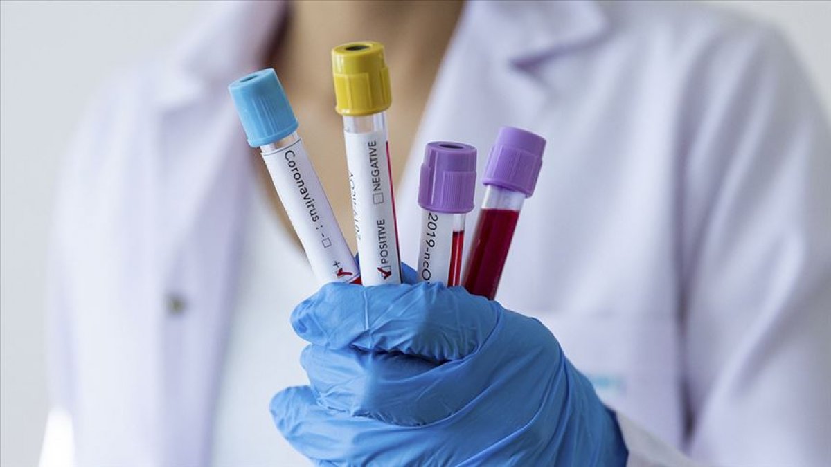 Coronavirus test in Germany will be 3 euros