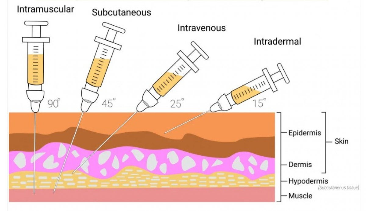 Подкожная и внутрикожная инъекция