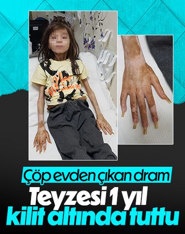 Bursa'da yeğenini çöp evde kilitli tutan kadın gözaltına alındı