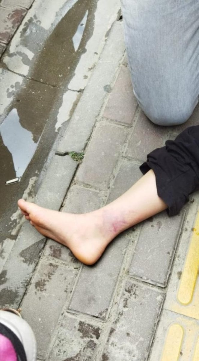 Kastamonu da sokak köpeğinden kaçan kızın ayağını otomobil ezdi #2