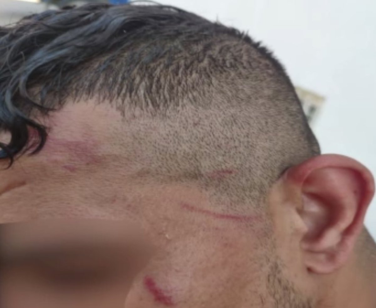 Yunan polisinden göçmenlere işkence: Önce dövdüler, sonra ölüme terk ettiler #6