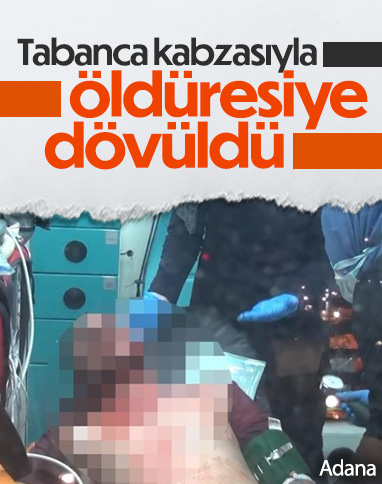 Adana'da bir kişi tabanca kabzasıyla öldüresiye darbedildi