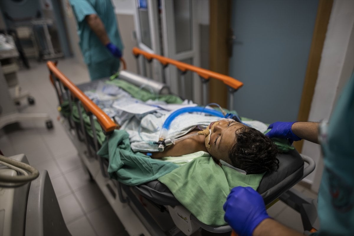 Gazan children injured in Israeli attacks under treatment #4