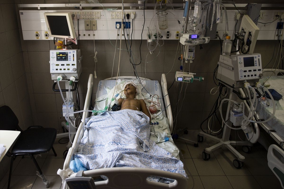 Gazan children injured in Israeli attacks are under treatment #2