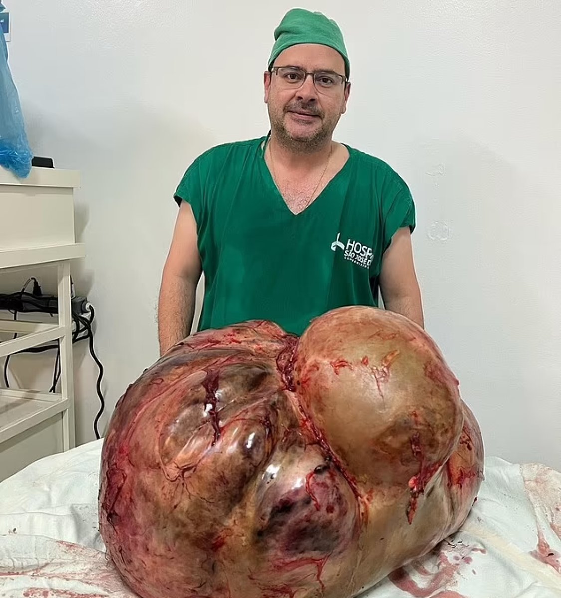 Brezilya da doktorlar, 45 kiloluk tümörü 2 saatte çıkardı #3
