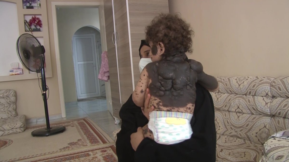 Hatay da Suriyeli bebeğin hastalığına teşhis aranıyor #4