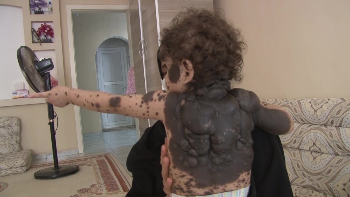 Hatay da Suriyeli bebeğin hastalığına teşhis aranıyor #5