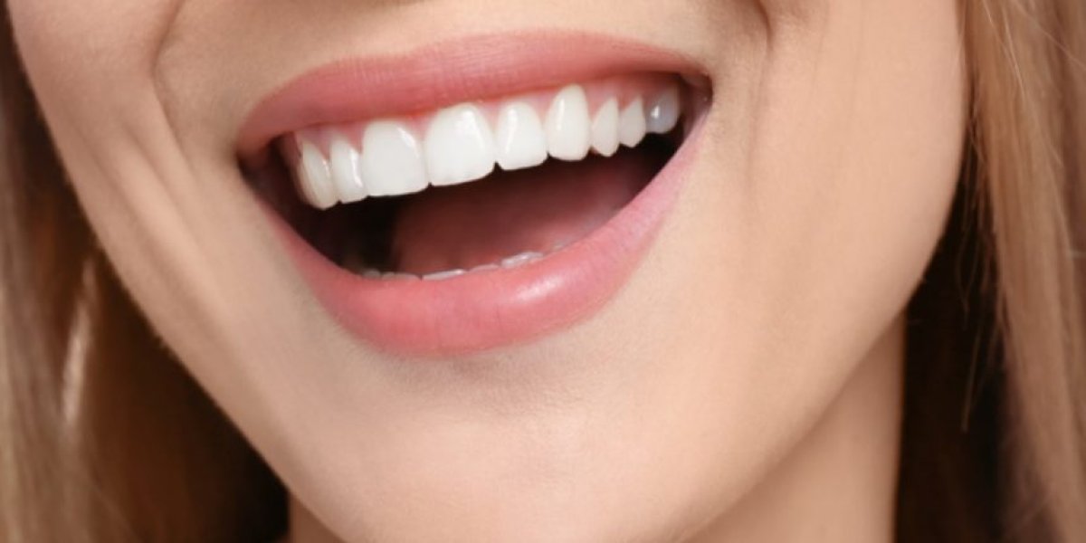 Hollywood gülüşü nedir, nasıl sahip olunur? İşte diş sağlığı için yapılması gerekenler! #1