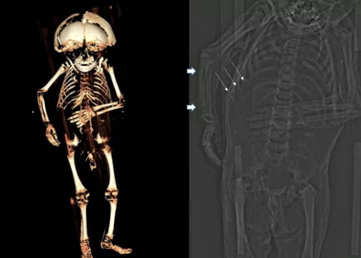 Cause of death of mummified baby 400 years ago revealed #2