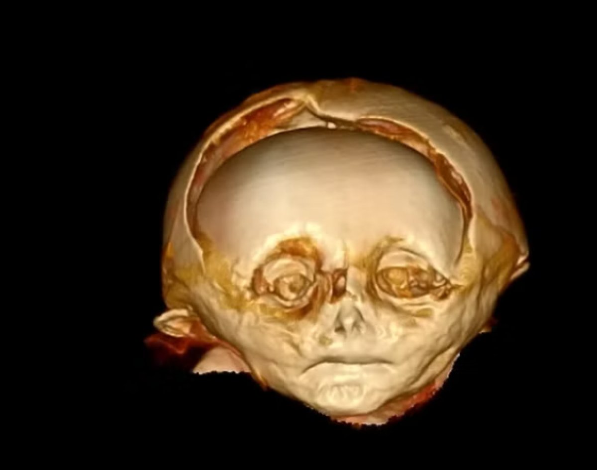 400 yıl önce mumyalanmış bebeğin ölüm nedeni ortaya çıktı #3