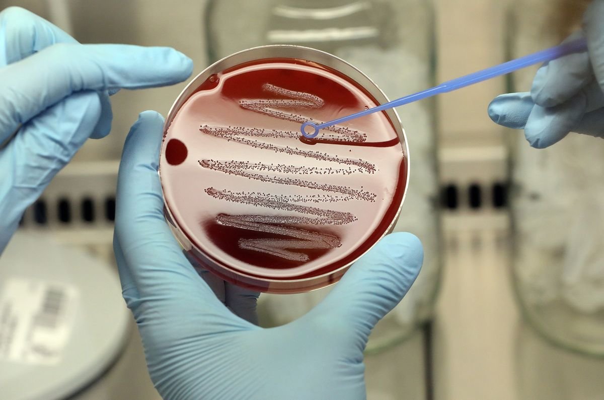 Ölümcül boğaz enfeksiyonu! Strep A bakterisi nedir, nasıl bulaşır? Strep A belirtileri #1