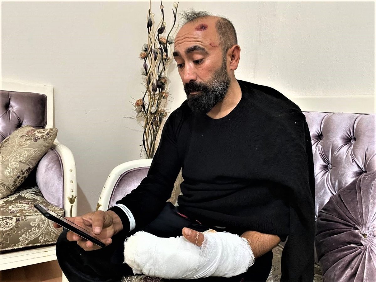 Antalya daki taksi şoförü, taşlı saldırıya uğradı #2