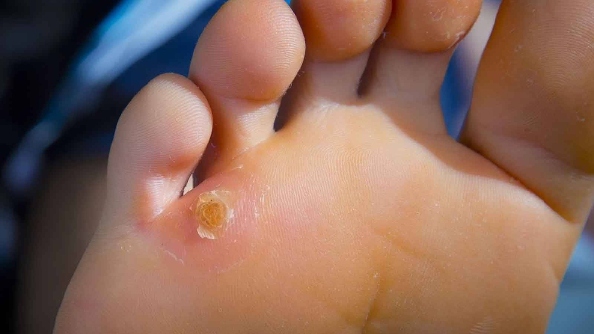 Kökten bitiriyor! Nasır yerine 1 dilim koyun, pamuk gibi oluyor...