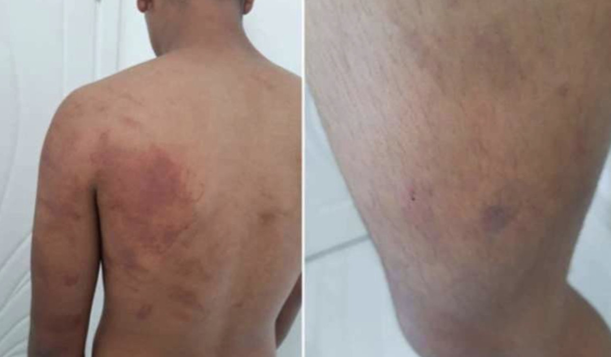 Şanlıurfa'da çocuğu zincirle ahıra bağlayıp işkence yapan baba ve amca tutuklandı