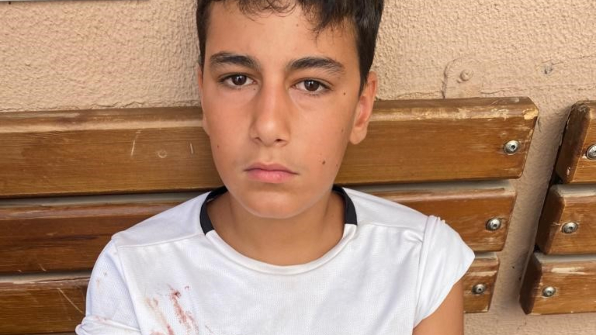 Antalya'da dershaneye giden çocuğa 5 köpek saldırdı: Zıplayıp kolumu ısırdı