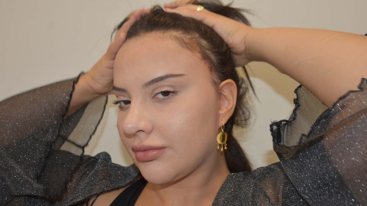 İzmir'de badem göz ameliyatı olan kadının yüzünde kalıcı izler oluştu