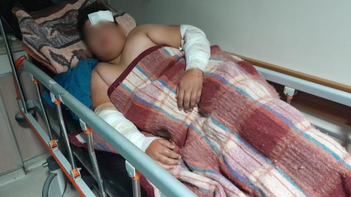 Konya'da başıboş sokak köpeklerinin kovaladığı çocuk yaralandı