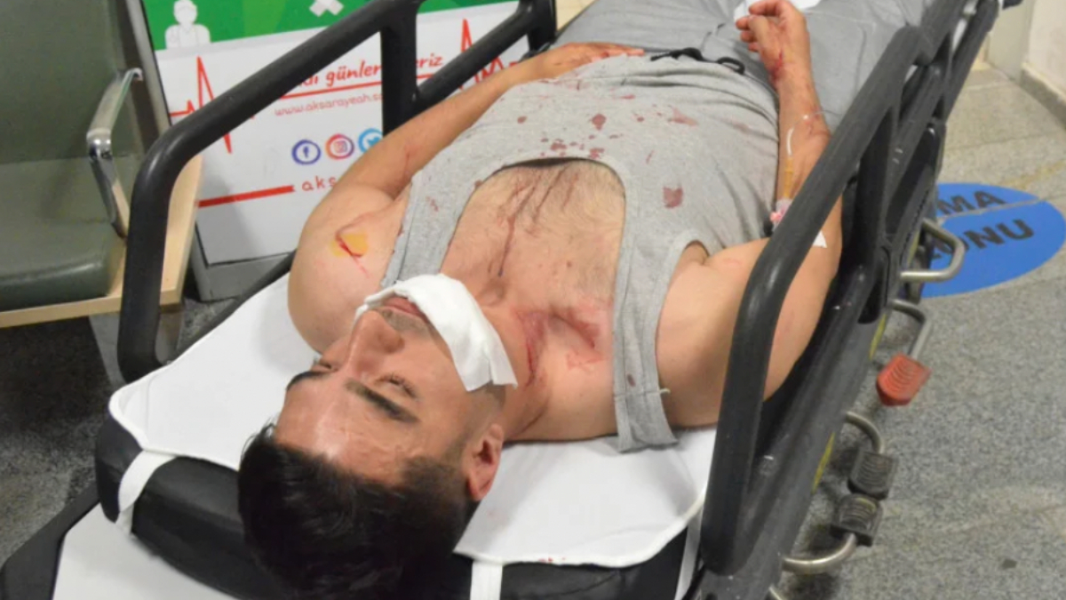 Aksaray'da ayağına basan adam tepki gösterince bıçaklandı