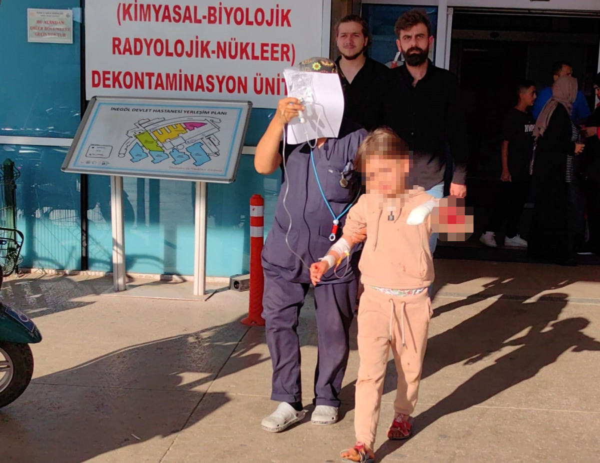 Bursa'da oyun sırasında 6 yaşındaki çocuğun 3 parmağı koptu