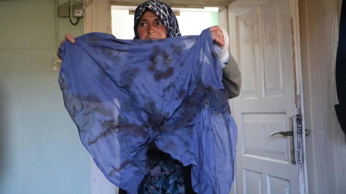 Bursa'da bir kadın köyde hayvanları otlatma kavgasında darbedildi