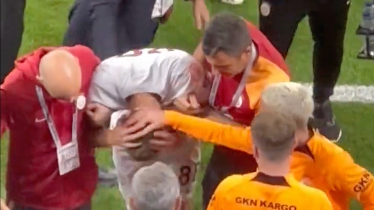 Galatasaray'da Kazımcan Karataş sakatlanınca gözyaşlarıyla kenara geldi