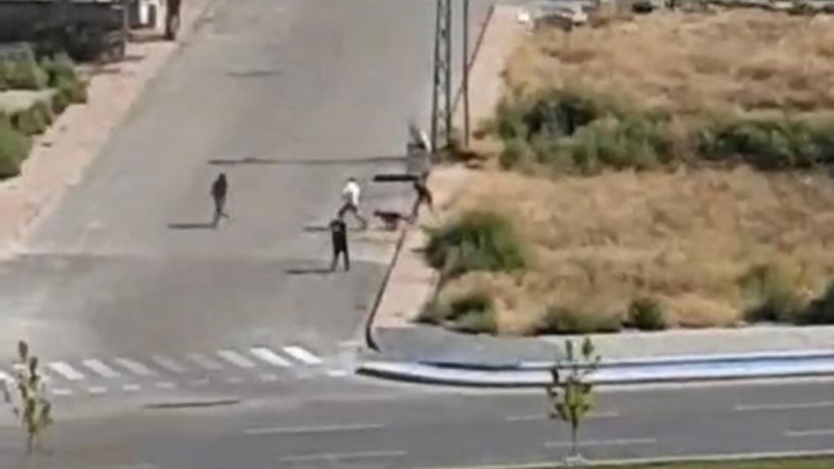 Kayseri'de sokak köpeğinin saldırısına uğrayan genç yaralandı