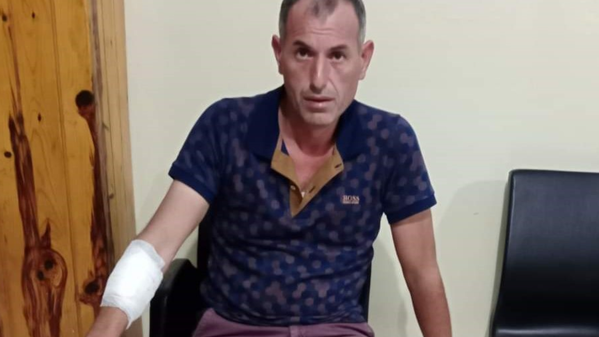 Aydın'da köpek saldırısına uğrayan adam isyan etti! Eti yiyen, sütü içen köpeklerin beni koydukları hale bakın