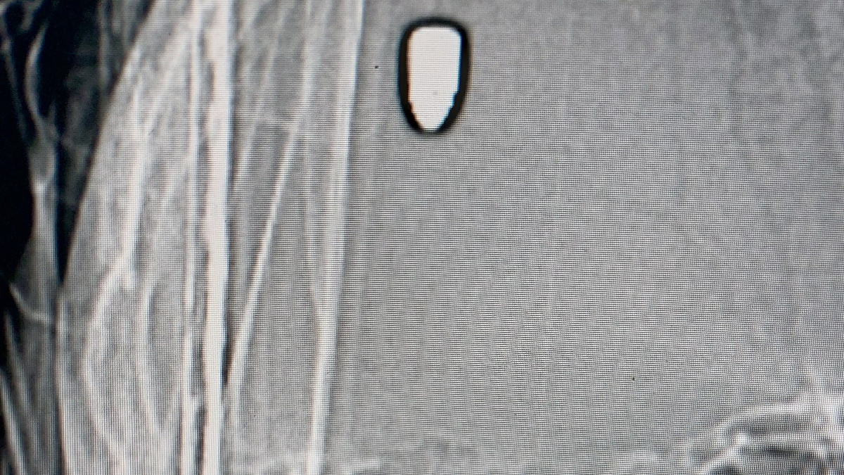 Samsun'da arkadaşını bekleyen gencin kafasına yorgun mermi isabet etti