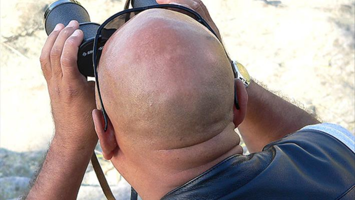 Canan Karatay sebebini açıkladı: Erkeklerin saçı bu yüzden dökülüyor