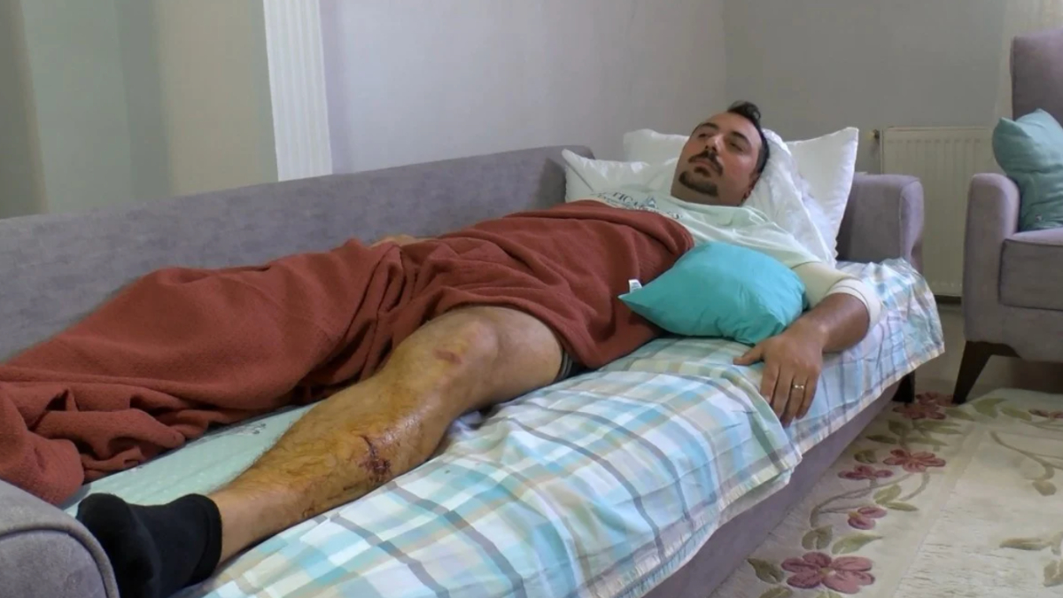 İstanbul'da pitbull saldırısının görüntüleri ortaya çıktı