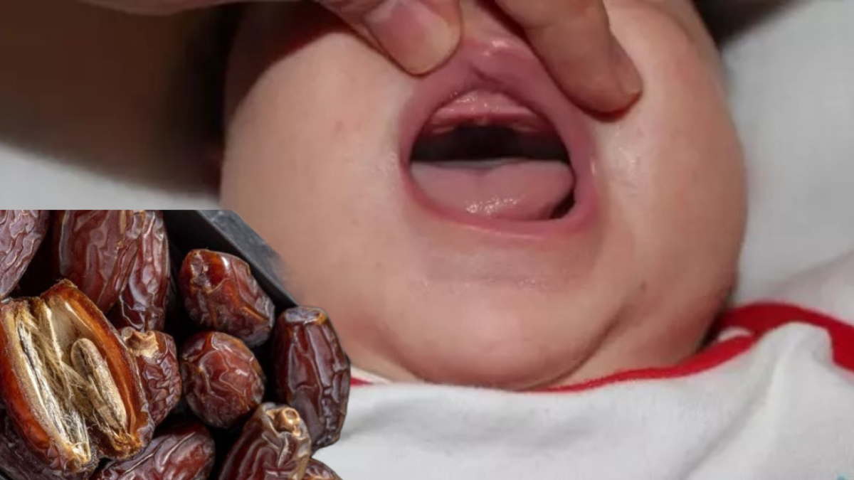 Yenidoğan sünneti: Damağa hurma sürülüyor, bakın ne işe yarıyor...