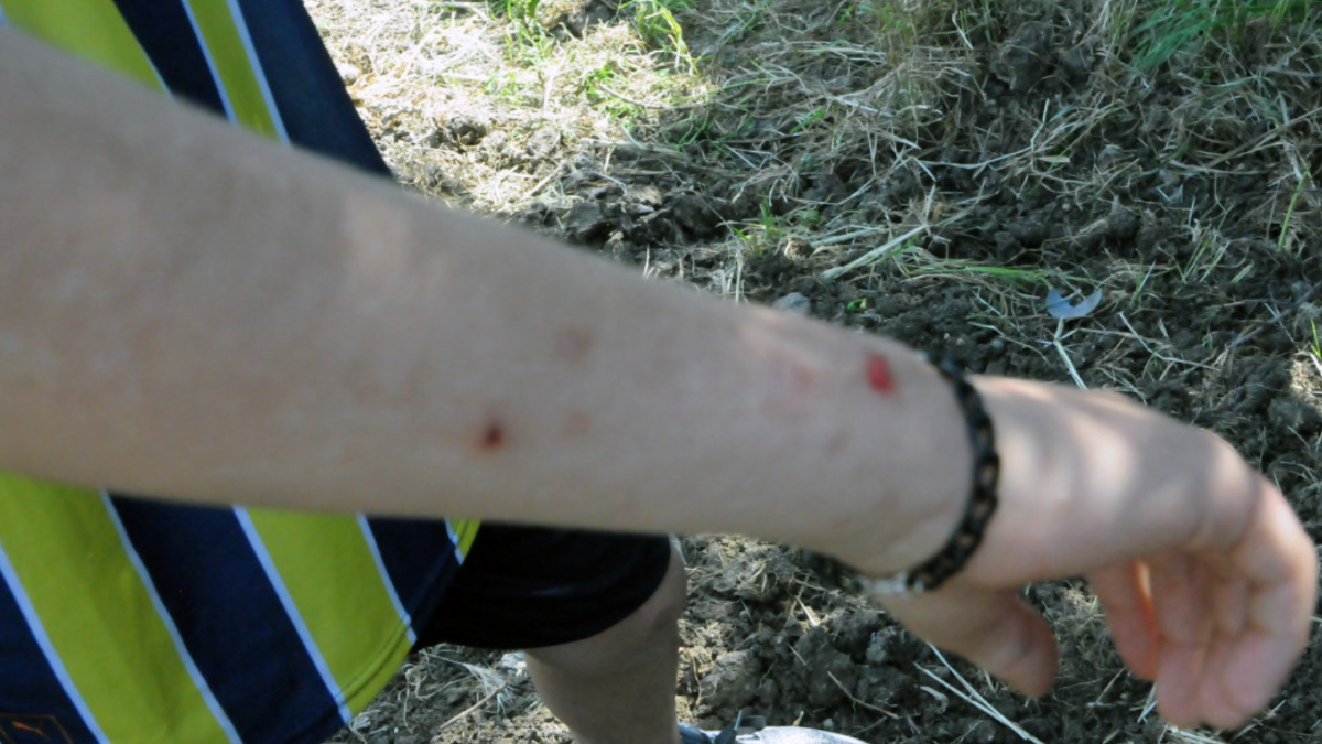 Hatay'da havalar ısınınca konteynerlerde sinek ve haşere sorunu başladı