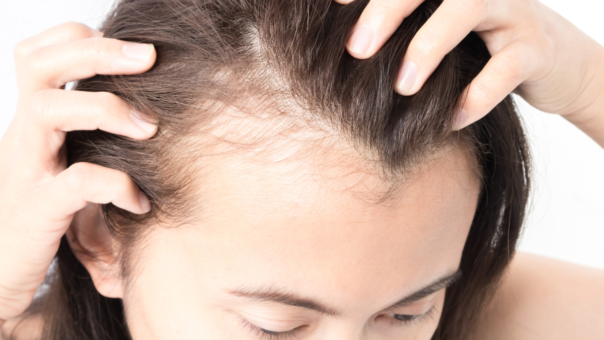 Saç dökülmesine hangi doktor bakar? Saçı dökülen hangi bölüme gitmeli?
