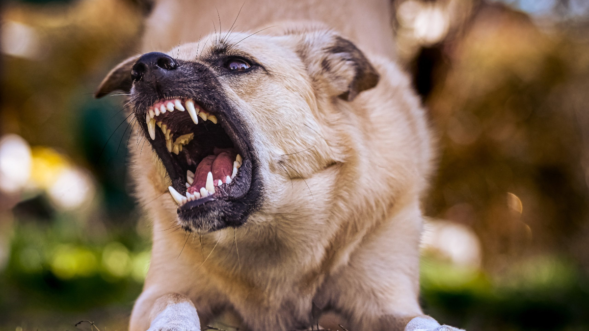 Kayseri’de sahipli köpek çocuğa saldırdı