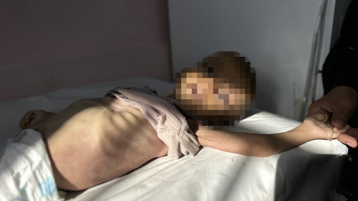 Gazze’de son 24 saatte 11 kişi açlıktan hayatını kaybetti