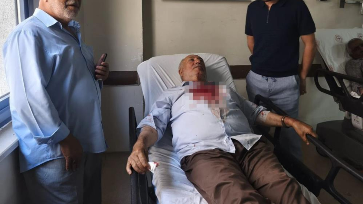 Iğdır'da kavgayı ayırmak isteyen imam yumruk yedi