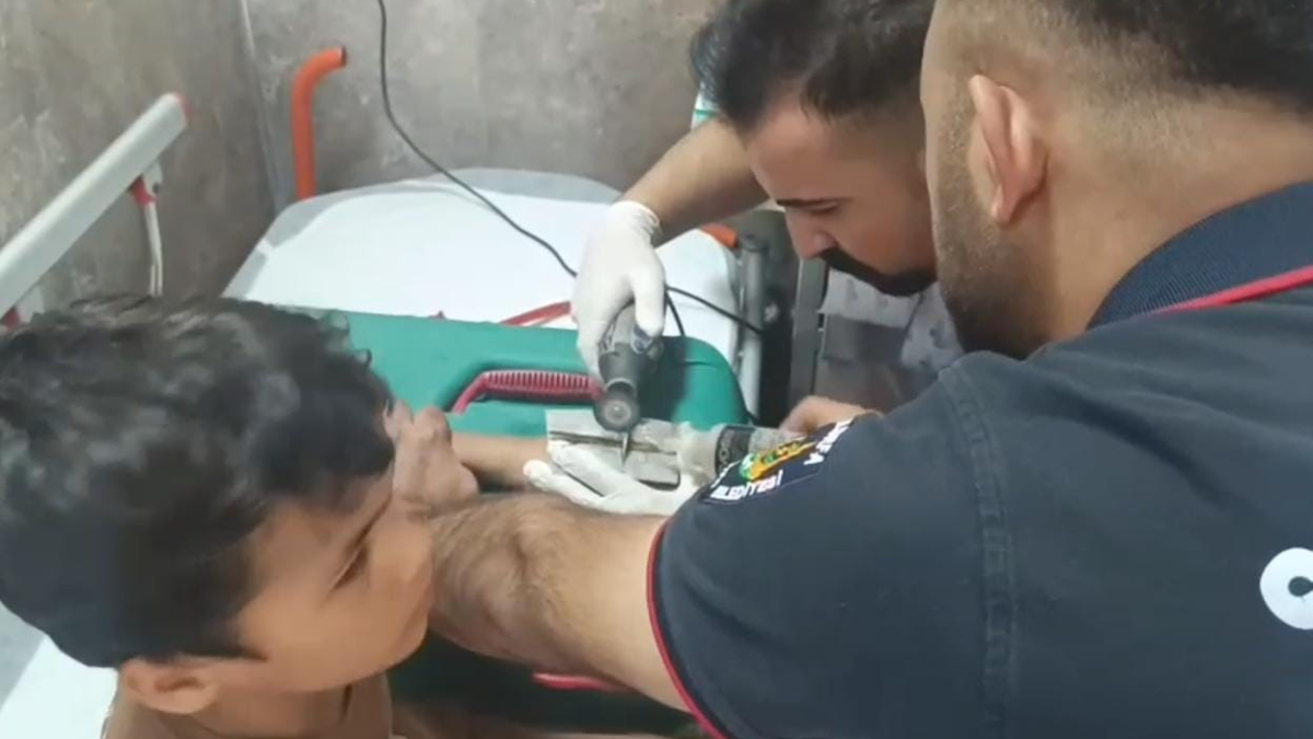 Şanlıurfa'da çocuğun parmağına sıkıştırdığı cıvata pulu kesilerek çıkartıldı